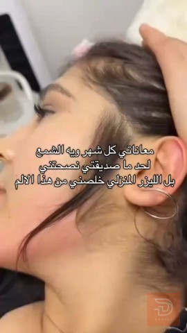جهاز ليزر ازالة الشعر IPL الاصلي جديد للبيع في بغداد