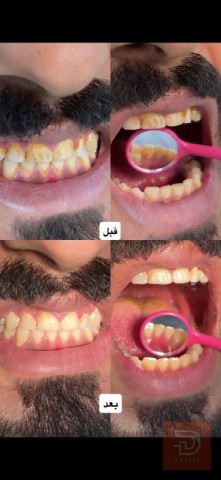 خدمات طب الأسنان - الدكتورة دانية الشمري في كربلاء المقدسة