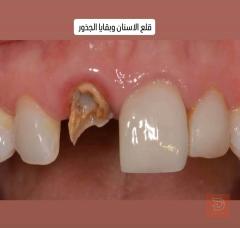 علاجات أسنان مجانية في كربلاء