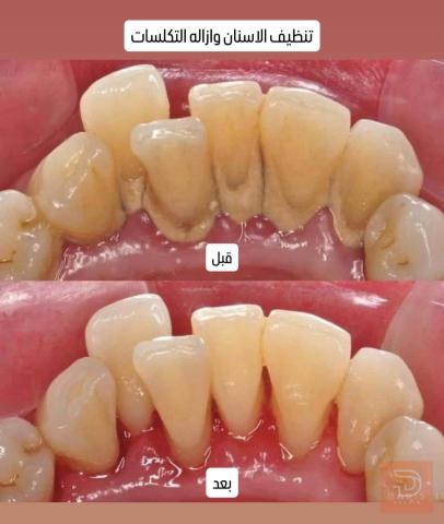 علاجات أسنان مجانية في كربلاء