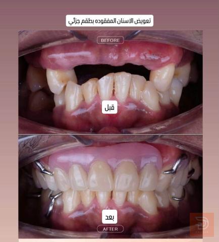 علاجات أسنان مجانية في كربلاء