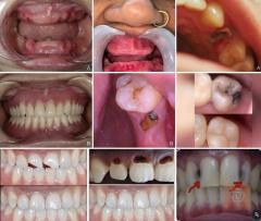 خدمات طب أسنان مجانية في كربلاء المقدسة