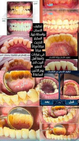 خدمات طب أسنان وحشوات وطقم أسنان في عموم العراق