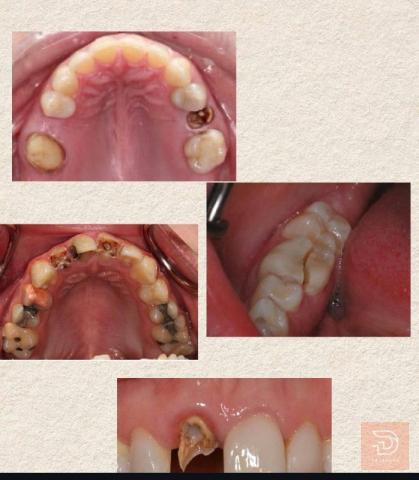 علاج اسنان في كربلاء المقدسة