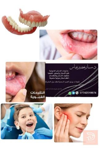 خدمات طب أسنان مجانية - الدكتورة مسار خضير في كربلاء المقدسة