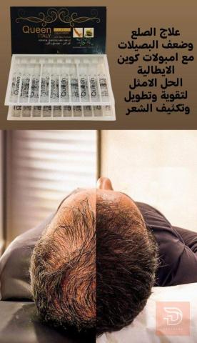 بكج امبولات كوين لتساقط الشعر ٢٠ امبوله للبيع في بغداد