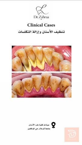 خدمات طب أسنان مجانية في جامعة كربلاء