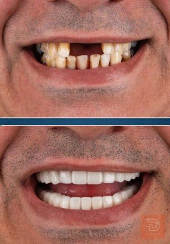 خدمات طب وجراحة الفم والأسنان مجانية في كربلاء المقدسة