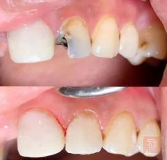 خدمات طب وجراحة الفم والأسنان مجانية في كربلاء المقدسة