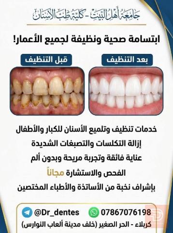 جلسات تنظيف وتلميع الأسنان في كربلاء المقدسة