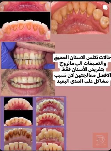 علاج أسنان مجاني في كربلاء المقدسة